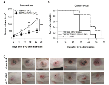 Effect of THOC2 knockdown in T98FR subcutaneous xenograft model