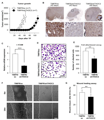 Reduced Cell Adhesion and Retarded Tumor Formation in T98FR/shTHOC2