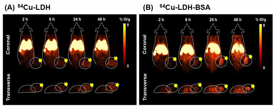 Positron Emission Tomography (PET) 이미징