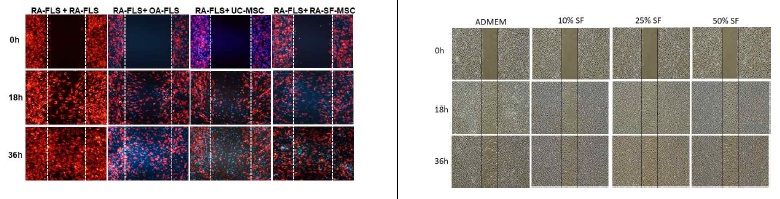 MSC의 RA-FLS 공격성 억제효과 실험을 위한 공배양 조건 확립. (A) RA-FLS는 PKH 26 cell tracking dye (red)와 핵을 염색하는 Hoechst 33342로 염색을 하고, MSC 들은 Hoechst 33342로만 염색 한 뒤, 1:1의 세포 비율로 섞어 공배양 함. 공격성 실험에서 RA-FLS + RA-FLS 실험군은 positive control group으로 RA-FLS + OA-FLS 실험군은 negative control group으로 사용함. (B) RA 환자의 활막액 (SF)을 공배양에 처리할 때의 조건을 확립을 위한 실험