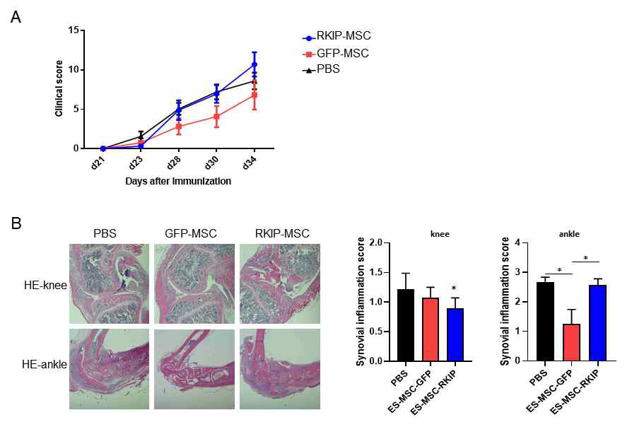 CIA 마우스 모델을 이용한 RKIP 탑재 MSC의 RA 치료 효과 검증 (A) 21일째 1 X 10^6 개의 세포를 무릎 에 주사하여 2주 동안 관찰한 결과 (B) 무릎과 발목의 H&E 염색을 통한 염증 정도를 나타낸 대표 사진과 정량화 한 그래프. *p < 0.05
