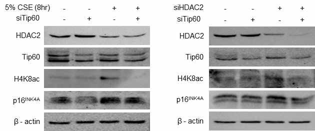 CSE, siHDAC2 처리 세포에 Tip60 넉다운에 의한 H4K8 아틸화 및 p16발현 변화