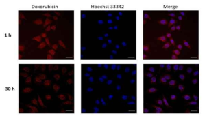 독소루비신-나노겔의 세포 내로의 흡수