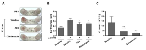 AC9 펩타이드의 in vivo 여드름 치료효능 검증