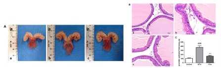 테스토스테론으로 유도된 전립선 비대 조직의 형태학적인 변화(A) 및 H&E staining(B)을 통한 전립선 상피 두께 비교(C)