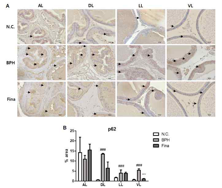 Rat 전립선 lobe별 p62의 발현 확인 (A) p62 면역조직화학 염색의 광학현미경 사진 (×400), (B) p62의 %면적 측정 그래프