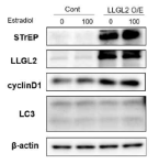 Estradiol로 유도된 BPH-1의 증식과정에서 LLGL2 유전자 과발현에 따른 cyclin D1 및 autophagy 관련인자의 발현 변화