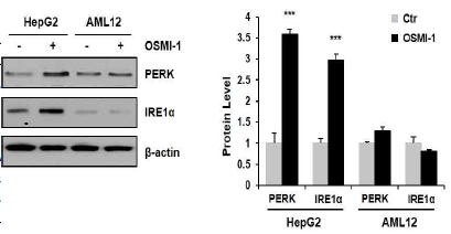 HepG2 와 AML12 세포에서 ER stress확인