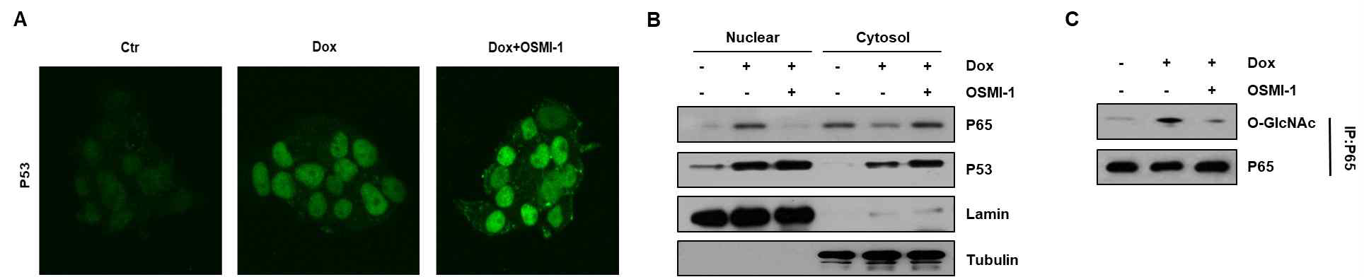 DOX와 OSMI-1 병행 처리 시 P53의 발현