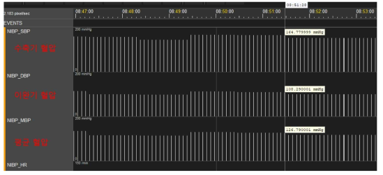 1분 단위로 측정되는 비침습적 혈압 측정 결과