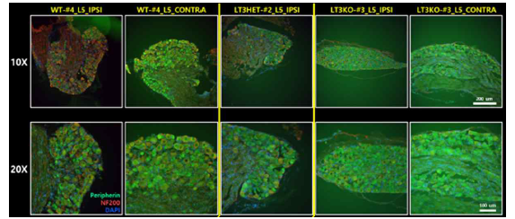 후근 신경절 조직 내 Peripherin, NF200 단백질 발현양상