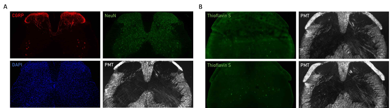 7개월령 알츠하이머병 동물모델(5xFAD) 쥐에서 척수내 CGRP, NeuN 및 Thioflavin S 발현을 확인함. (A) 7개월령 알츠하이머병 동물모델(5xFAD) 쥐의 척수내 통증관련 단백질인 CGRP는 dorsal horn (DH)에서 superficial과 deep laminae와 ventral horn (VH)의 motor neurons에서 발현하는 것을 확인하였고, 신경세포 marker인 NeuN의 발현은 척수내 전반적으로(DH and VH) 발현하는 것을 확인함. (B) 7개월령 알츠하이머병 동물모델(5xFAD) 쥐의 척수내 알츠하이머병 관련 단백질인 beta-amyloid plaque 발현은 DH에서는 관찰되지 않으나, VH에서만 특이적으로 관찰하였음