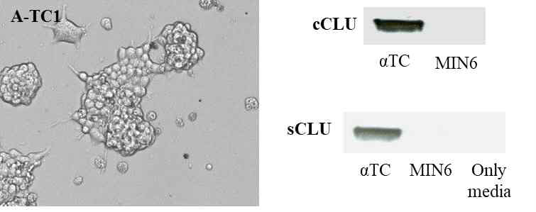 알파세포주 (Alpha-TC1)의 형태 및 Clusterin의 검출 (cCLU-cytosolic Clusterin; sCLU-sercreted Clusterin). MIN6 세포 및 Only media는 negative control로 사용됨