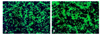 알파세포주 (Alpha-TC1)의 형태 및 Clusterin의 검출 (cCLU-cytosolic Clusterin; sCLU-sercreted Clusterin). MIN6 세포 및 Only media는 negative control로 사용됨