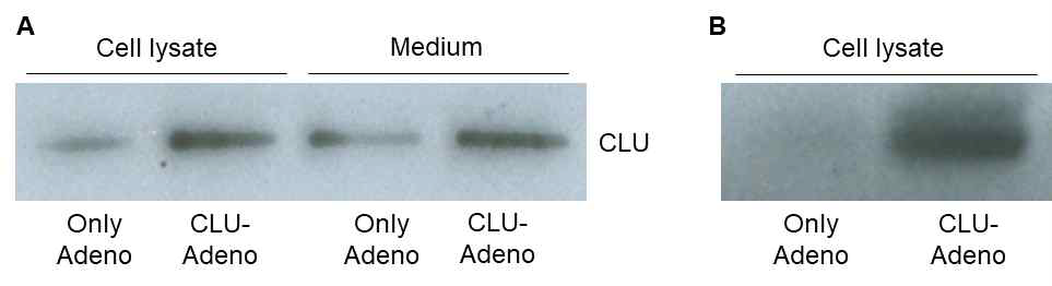 CLU-Adenovirus를 통한 clusterin과 GFP의 발현 양상. (A) CLU-Adenovirus 감염에 의하여, 세포 내 Clusterin의 발현이 현저히 증가하였고, 배양액으로 분비된 clusterin 또한 유의하게 증가함을 관찰함. (B) CLU-Adenovirus에 삽입된 GFP 단백질을 Antibody를 이용하여 관찰하였고. CLU-Adenovirus에 감염된 세포에서만 관찰됨