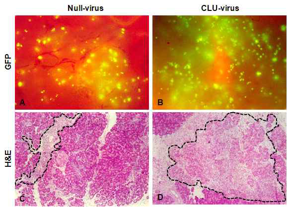 Null- 및 Clu-Adenovirus 주입에 의한 GFP 발현 및 췌장의 조직학적 변화. (A, B) Virus 주입 1주일 후 췌장 조직 발현되는 GFP의 형광현미경 관찰 모습 (A, B). H&E 염색에 의하여 관찰된 조직의 변화 모습. 특이적 염증반응 부위 (C) 및 췌장 조직 재생과 유사한 이상 조직변형 부위 (D)