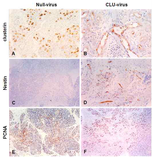 췌장 내 clusterin 과발현에 의한 특이적 단백질의 발현 양상. Null-, CLU-virus를 주입한 동물모델의 췌장 조직에서 clusterin (A, B), Nestin (C, D), PCNA (E, F)의 발현양상