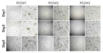 확립된 PDAC유래 pancreatic cancer organoid의 확립