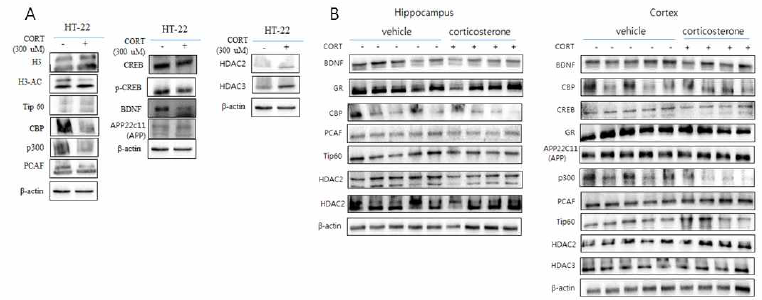 In vitro 및 in vivo (brain)에서의 H HAT/ HDAC protein 및 관련 인자의 발현 비교