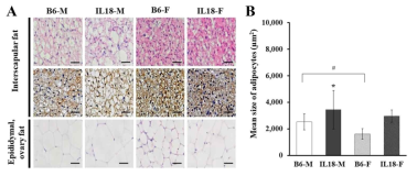 IL-18 유전자 결손 마우스의 지방 조직 면역염색 및 지방 세포 평균 크기