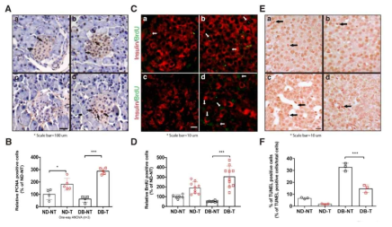 실크피브로인 투여 후 췌장 베타세포 증식 및 세포사멸 변화