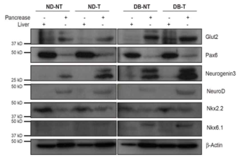 실크피브로인 투여 후 간과 췌장의 단백질 발현 변화