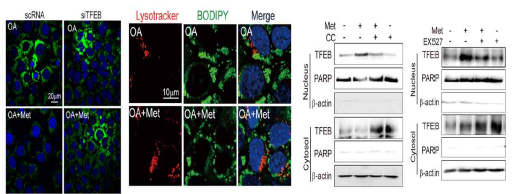 TFEB를 통한 metformin의 autophagy/lipophagy 효과