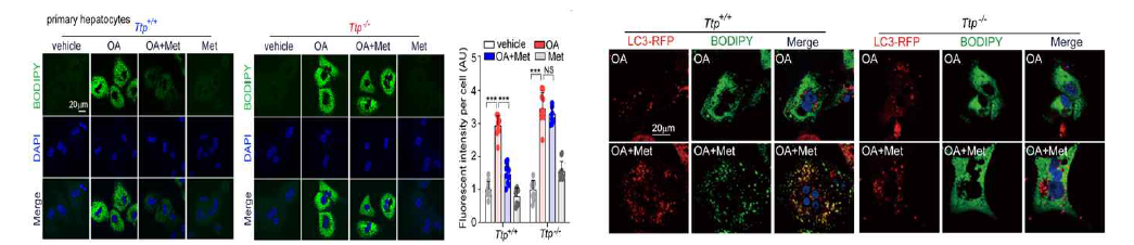 TTP를 통한 metformin의 lipophagy와 lipid 분해 효과