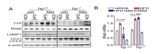 TTP를 통한 metformin으로 유도된 autophagy lysosome pathway 증가 효과