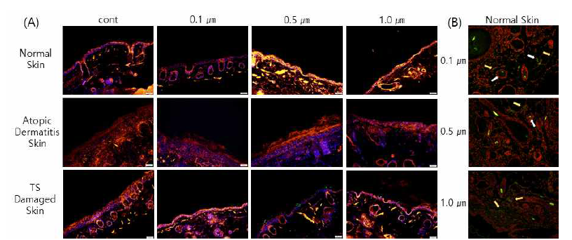 Fluorescent image of microplastic (100ppm, 24h) penetration in hairless mouse. (A) Normal skin, Atopic dermatitis skin or TS damaged skin (in vivo), (B) Normal skin (ex-vivo). Green: microplastics, Red: actin, Blue: nucleus, ⇨: Microplastics in hair follicle