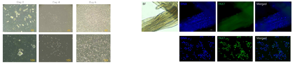 Isolation and Characterization of satellite cells from Hanwoo