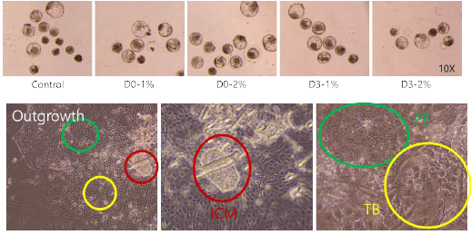 배양액 조성에 따른 배반포 형태(위) 및 outgrowth 후 콜로니 형태(아래)