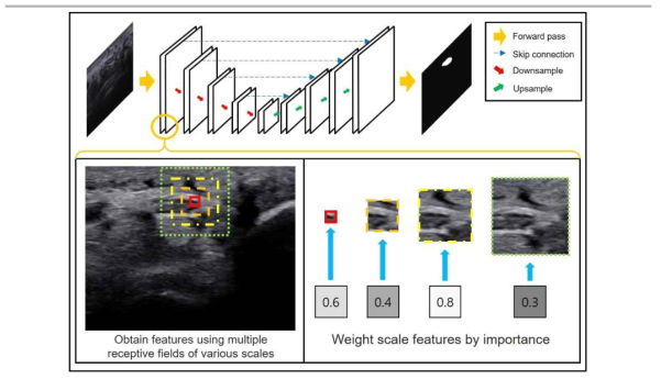 본 연구팀이 신경 초음파 이미지 분할에 특화하여 개발한 Scale-Attentional U-Net 개요도