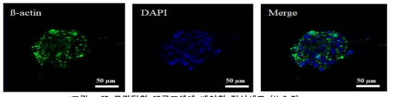 프린팅한 3D구조체에 배양한 정상세포 (HaCaT)