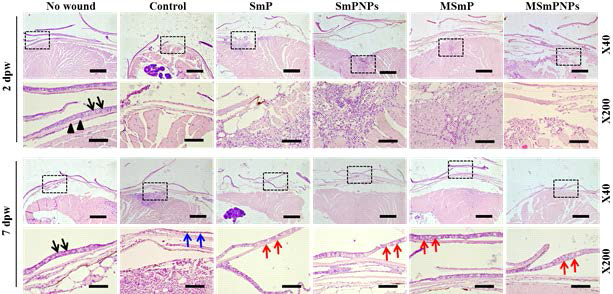 Hematoxylin and eosin (H&E) staining of transverse sections through the wound