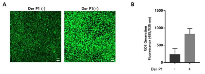 집먼지 진드기(Der p1)을 처리 후 oxidative stress 지표 변화 측정. (A) confocal microscopy. scale bar 20 μm (B) fluorometer 측정