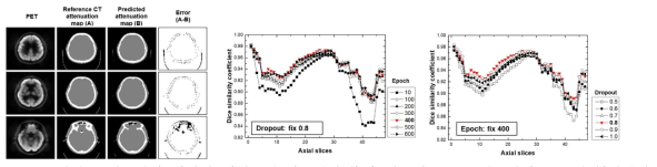 CT 영상을 사용하여 생성한 감쇠보정맵(두번째열)과 학습된 CNN을 사용하여 PET 영상(첫번째열)으로부터 생성한 감쇠보정맵(세번째열)을 뺀 차이 영상(네번째열). 학습 횟수와 드롭아웃 값을 변경하면서 딥러닝으로 생성한 감쇠보정맵과 CT 영상을 사용하여 생성한 감쇠보정맵의 차이를 다이스 유사율을 사용하여 정량 분석한 결과