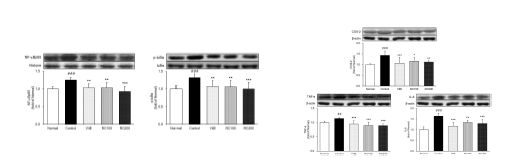 NF-κBp65와 p-IκBɑ 염증 경로 단백질 발현량 분석