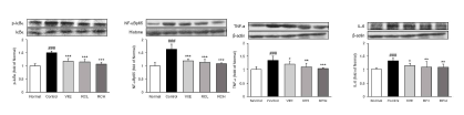 NF-κBp65 염증 경로 단백질 발현량 분석