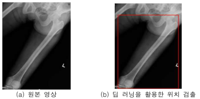 영상 분할을 위한 위치 정보 확인 연구 영상