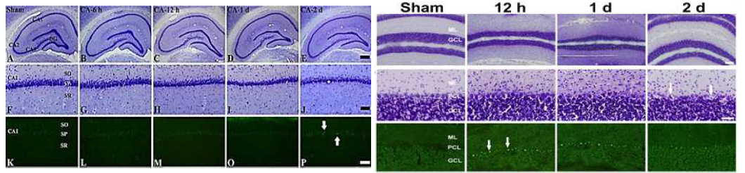 심정지 동물모델의 해마(우측) 및 소뇌(좌측)에서 신경세포사멸 양상