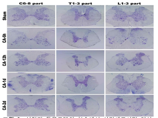 심정지 동물모델의 척수에서 신경세포사멸 양상