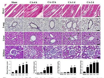 심정지 동물모델에서 심장, 폐, 간, 신장 조직 손상 양상