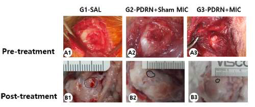 Gross morphological (A1–B3) findings of the subscapularis tendons in G1-SAL, G2-PDRN+Sham MIC, and G3-PDRN+MIC. (A1-A3) Pre-treatment images; (B1-B3) Post-treatment images