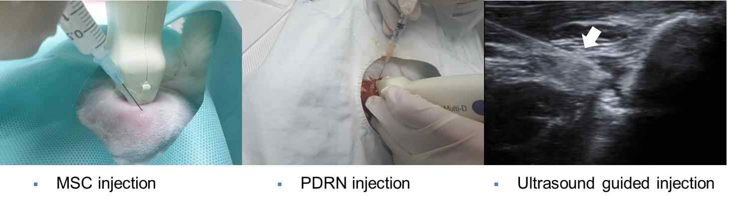 Mesenchymal stem cell and/or polydeoxyribonucleotide injection was made in the supraspinatus full-thickness tears under ultrasound guidance. Longitudinal ultrasound image showed the needle (arrows) in the supraspinatus of the rabbit