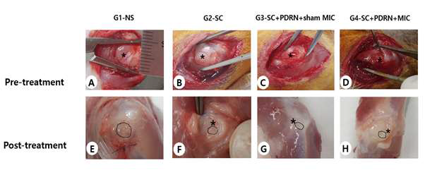 Gross morphology of the supraspinatus tendon. Gross morphological (A-H) findings of the supraspinatus tendons in G1-NS, G2-SC, G3-SC+PDRN+sham MIC, and G4-SC+PDRN+MIC. (A-D) Pre-treatment images; (E-H) Post-treatment images. Mean tendon tear size in group 2, group 3, and group 4 was significantly smaller than that in group 1 (p < .05). Abbreviations are NS, Normal saline; SC, human umbilical cord blood-derived mesenchymal stem cell; PDRN, polydeoxyribonucleotides; MIC, Microcurrent therapy
