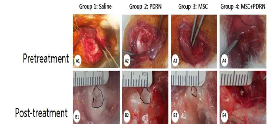 Gross morphological (A1-B4) findings of the subscapularis tendons in groups 1, 2, 3 and 4. (A1-A4): Pre-treatment images. (B1-B4): Post-treatment images