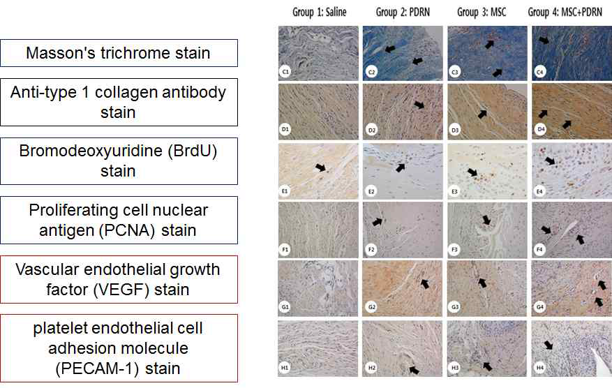 Gross morphological (A1–B4) and immunohistochemical (C1-H4) findings of the subscapularis tendons in groups 1, 2, 3, and 4. (A1-A4) Pre-treatment images; (B1-B4) Post-treatment images. (C1-C4) Newly regenerated tendons are shown in the blue-stained fibers (black arrow; Masson’s trichrome stain; X200) in group 2, 3, and 4. Few regenerative collagen fibers were seen in group 1. (D1-D4) Regenerated tendon fibers (black arrow; X200) were stained with anti-type 1 collagen antibody in group 2, 3, and 4. Few regenerated tendon fibers were seen in group 1. (E1-F4) Numerous BrdU and PCNA stained cells (black arrow, X400, X200) were observed in regenerated tendon fibers in group 2, 3, and 4. Few BrdU and PCNA stained cells were observed in group 1. (G1-H4) Numerous VEGF-positive cells and PECAM-1 positive microvascular densities (black arrows, X200) were observed in group 2, 3, and 4. Few VEGF-positive cells and PECAM-1 positive microvascular densities were observed in group 1. Abbreviations are MSC : human umbilical cord blood-derived mesenchymal stem cell; PDRN : polydeoxyribonucleotide; VEGF : vascular endothelial growth factor; and PECAM : platelet endothelial cell adhesion molecule