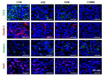 HSE와 GEM 병용 처리가 췌장암 특이적 미세환경에 미치는 영향