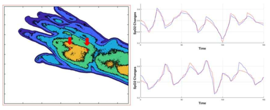 Oxygen Saturation Contour Map